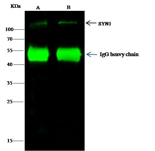 Synapsin 1 Antibody in Immunoprecipitation (IP)