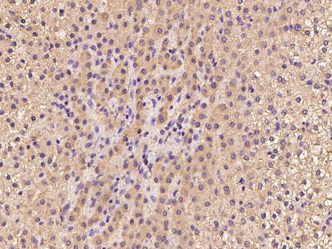 TBCE Antibody in Immunohistochemistry (Paraffin) (IHC (P))