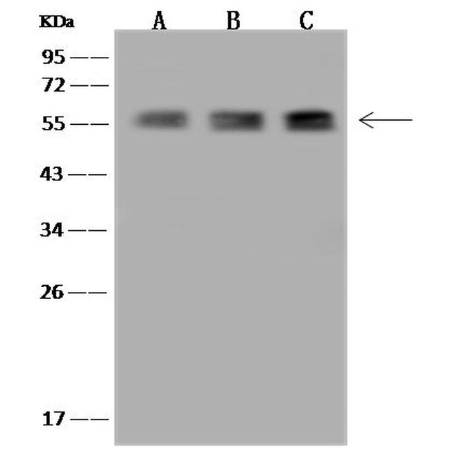 TBCE Antibody in Western Blot (WB)