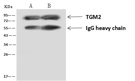 TGM2 Antibody in Immunoprecipitation (IP)