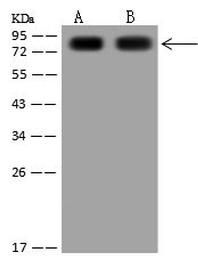 TGM2 Antibody in Western Blot (WB)