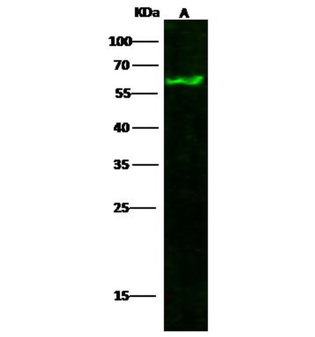 Tyrosine Hydroxylase Antibody in Western Blot (WB)