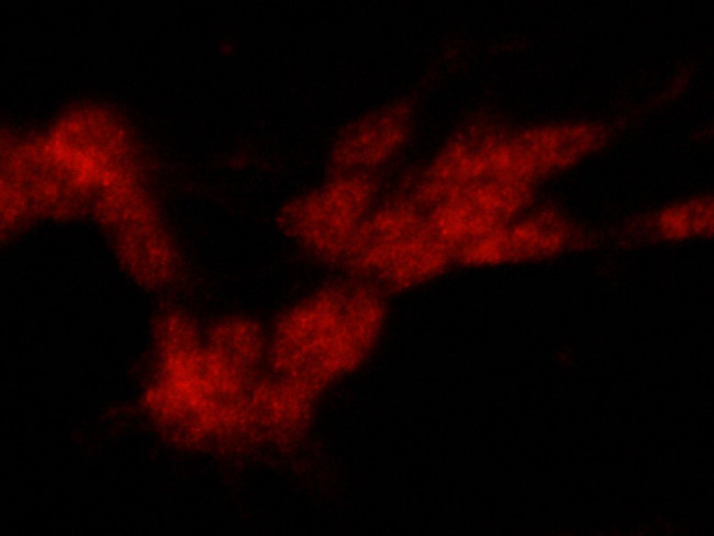 Tyrosine Hydroxylase Antibody in Immunocytochemistry (ICC/IF)