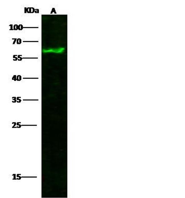 Tyrosine Hydroxylase Antibody in Western Blot (WB)