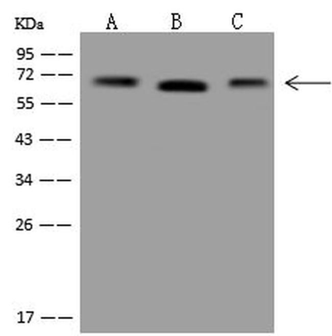 Transketolase Antibody in Western Blot (WB)