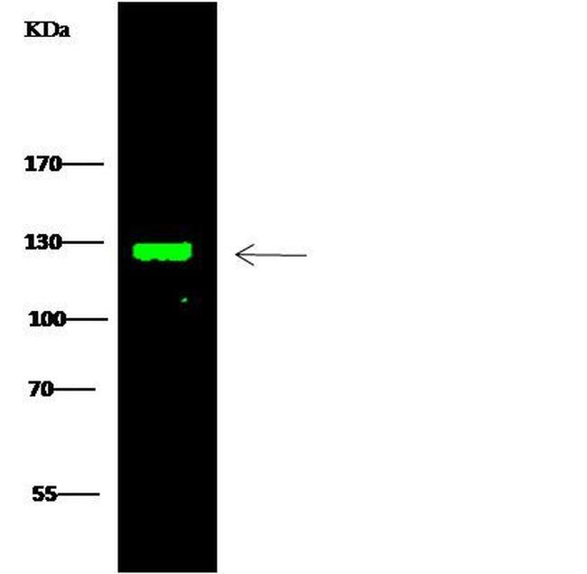 TRIM37 Antibody in Western Blot (WB)