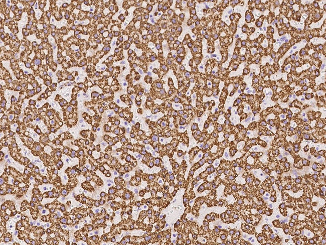 TST Antibody in Immunohistochemistry (Paraffin) (IHC (P))