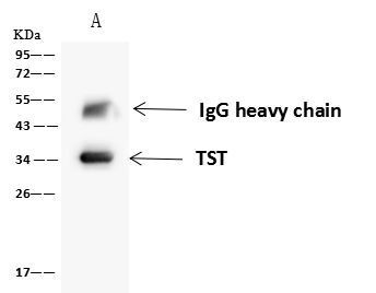 TST Antibody in Immunoprecipitation (IP)