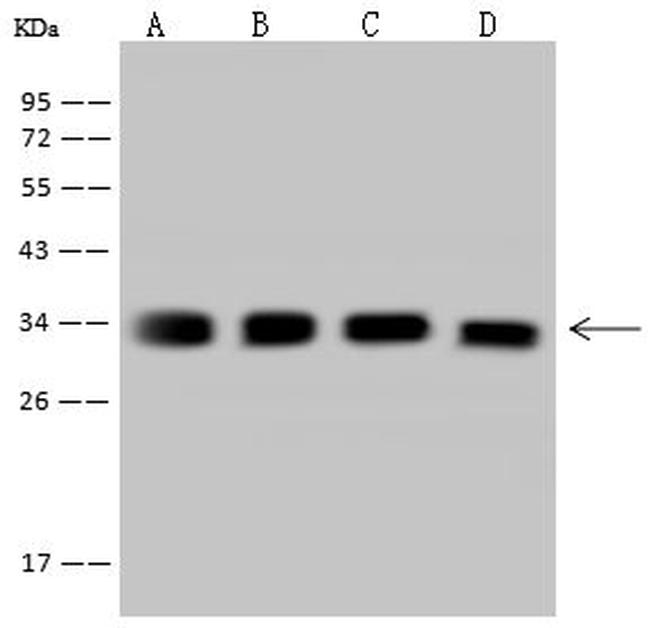 TST Antibody in Western Blot (WB)