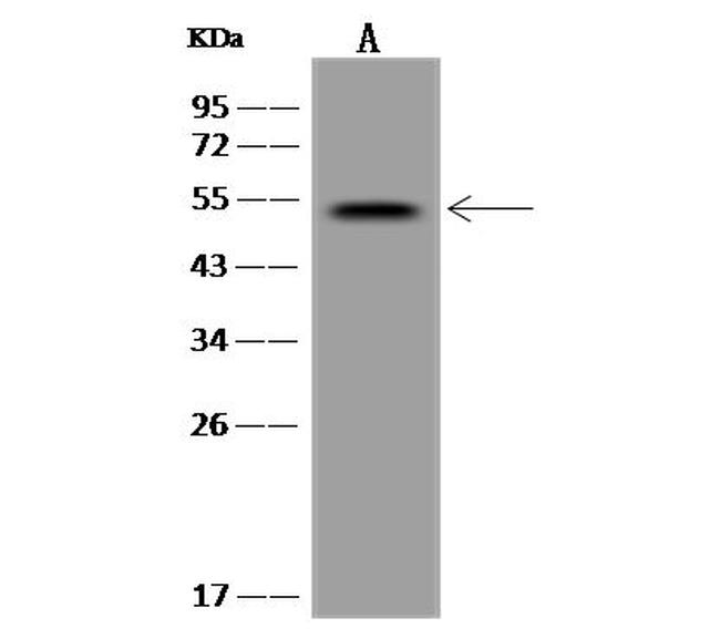 TTC23 Antibody in Western Blot (WB)