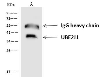 UBE2J1 Antibody in Immunoprecipitation (IP)