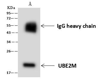 UBE2M Antibody in Immunoprecipitation (IP)