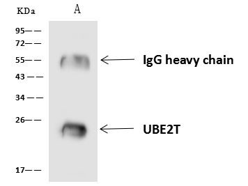 UBE2T Antibody in Immunoprecipitation (IP)