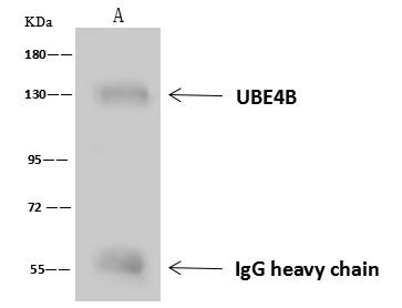 UBE4B Antibody in Immunoprecipitation (IP)