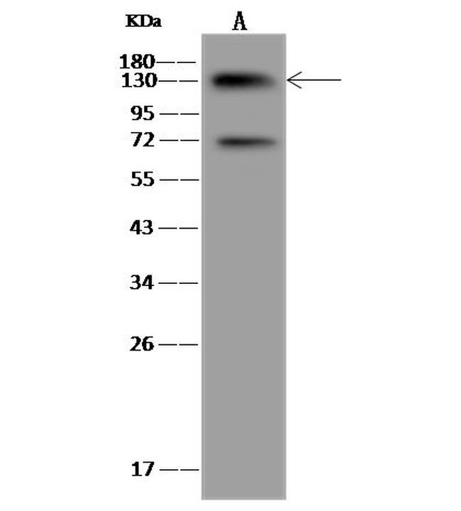 UBE4B Antibody in Western Blot (WB)