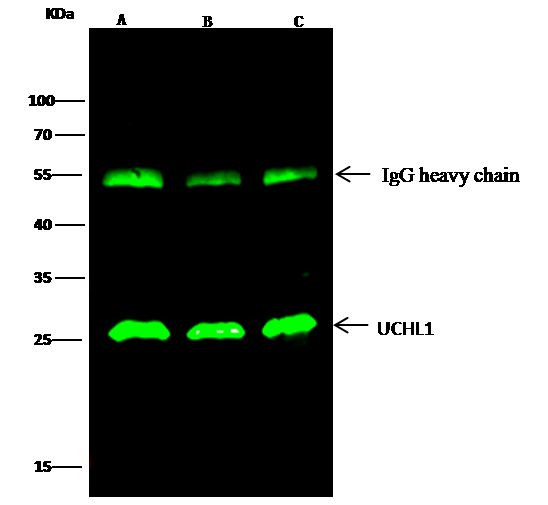 PGP9.5 Antibody in Immunoprecipitation (IP)