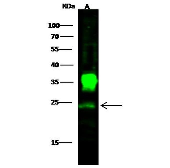 PGP9.5 Antibody in Western Blot (WB)