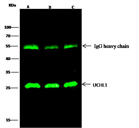 PGP9.5 Antibody in Immunoprecipitation (IP)