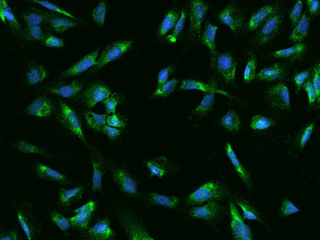 UCKL1 Antibody in Immunocytochemistry (ICC/IF)