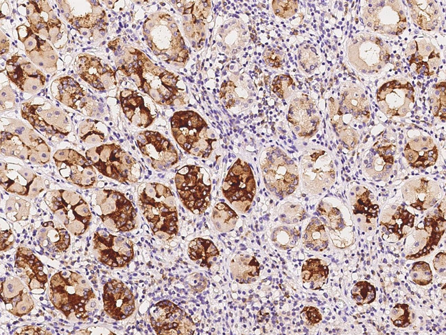 UCKL1 Antibody in Immunohistochemistry (Paraffin) (IHC (P))