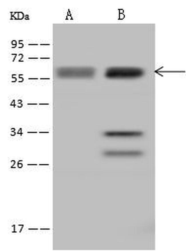 UCKL1 Antibody in Western Blot (WB)