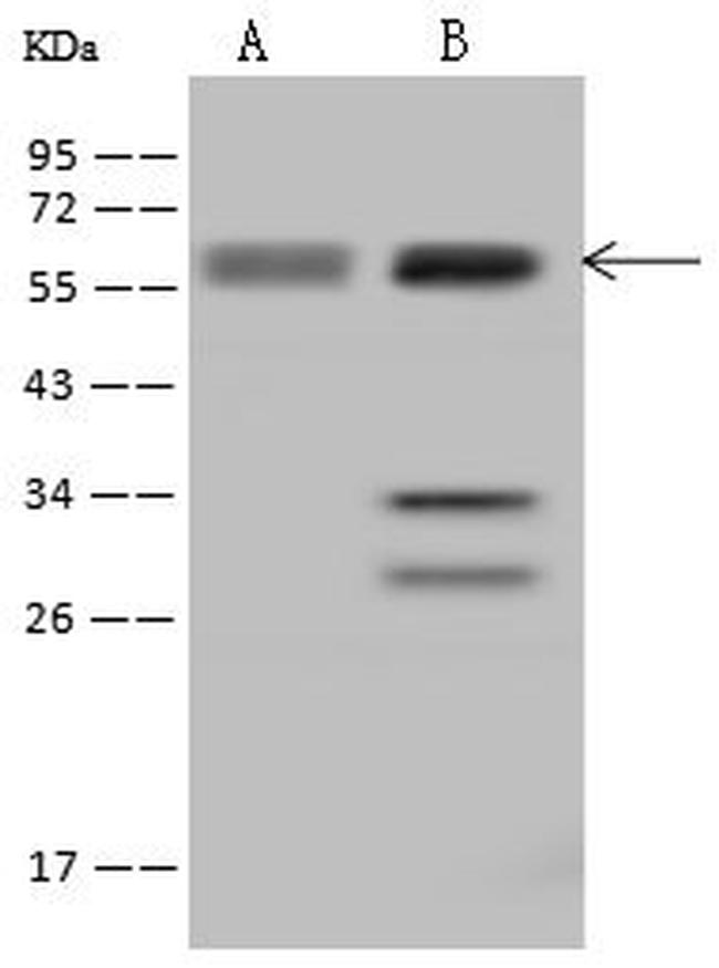 UCKL1 Antibody in Western Blot (WB)