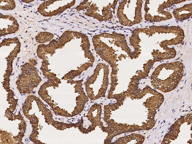 UGDH Antibody in Immunohistochemistry (Paraffin) (IHC (P))