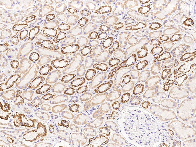 UQCRB Antibody in Immunohistochemistry (Paraffin) (IHC (P))