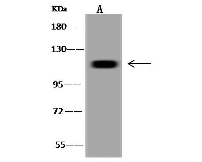 USP13 Antibody in Western Blot (WB)