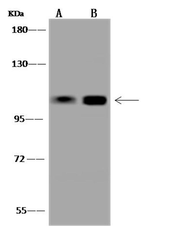 USP28 Antibody in Western Blot (WB)