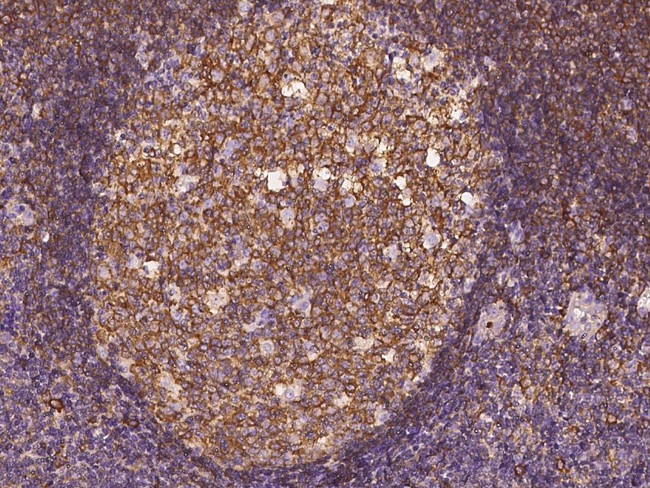 VASP Antibody in Immunohistochemistry (Paraffin) (IHC (P))