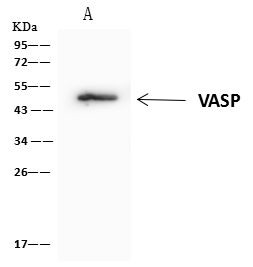 VASP Antibody in Immunoprecipitation (IP)