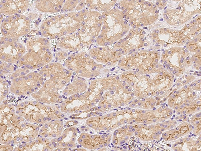 Vinculin Antibody in Immunohistochemistry (Paraffin) (IHC (P))