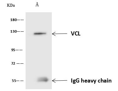 Vinculin Antibody in Immunoprecipitation (IP)