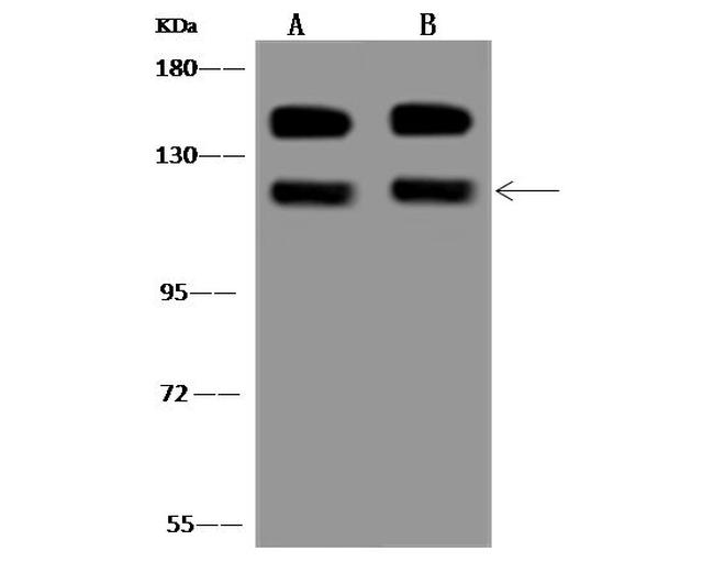 Vinculin Antibody in Western Blot (WB)