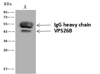 VPS26B Antibody in Immunoprecipitation (IP)