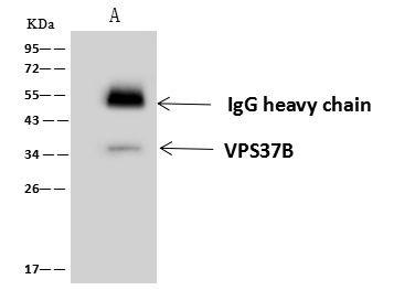 VPS37B Antibody in Immunoprecipitation (IP)