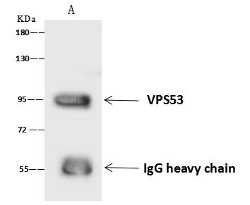 VPS53 Antibody in Immunoprecipitation (IP)