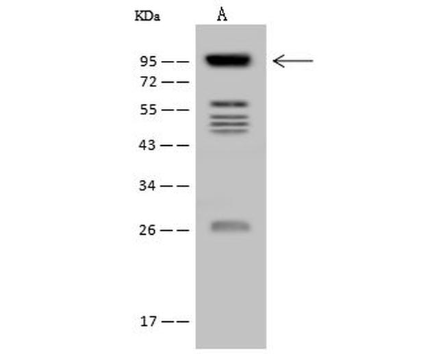 VPS53 Antibody in Western Blot (WB)