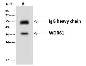 WDR61 Antibody in Immunoprecipitation (IP)