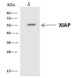 XIAP Antibody in Immunoprecipitation (IP)