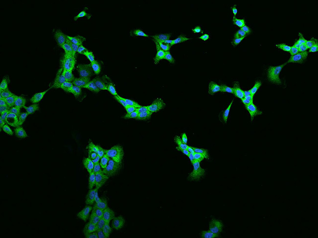 ZC3H7A Antibody in Immunocytochemistry (ICC/IF)