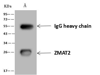 ZMAT2 Antibody in Immunoprecipitation (IP)