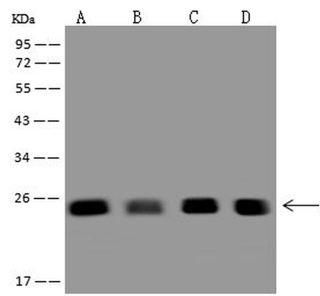 ZMAT2 Antibody in Western Blot (WB)