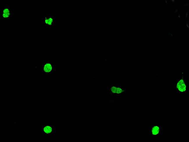 ZNF711 Antibody in Immunocytochemistry (ICC/IF)