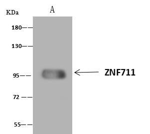 ZNF711 Antibody in Immunoprecipitation (IP)