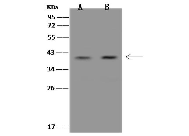 ZWINT Antibody in Western Blot (WB)