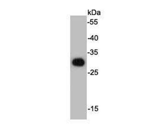 HSV tag Antibody in Western Blot (WB)