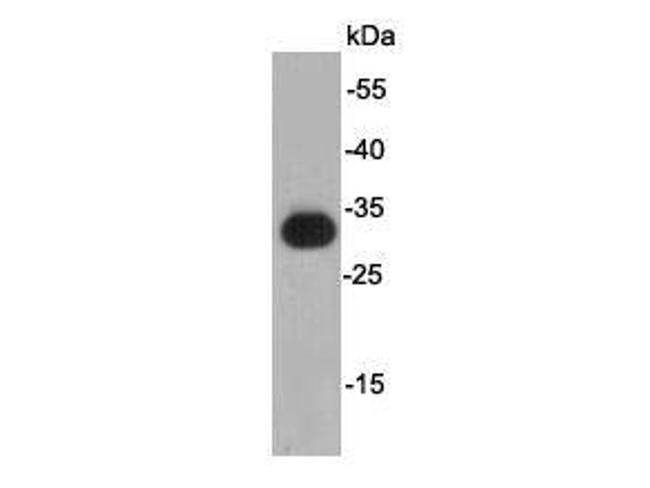 KT3 tag Antibody in Western Blot (WB)