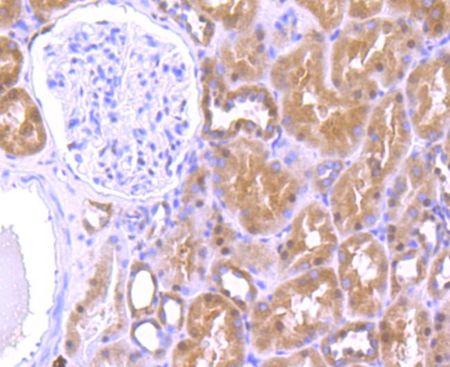 HMGB2 Antibody in Immunohistochemistry (Paraffin) (IHC (P))